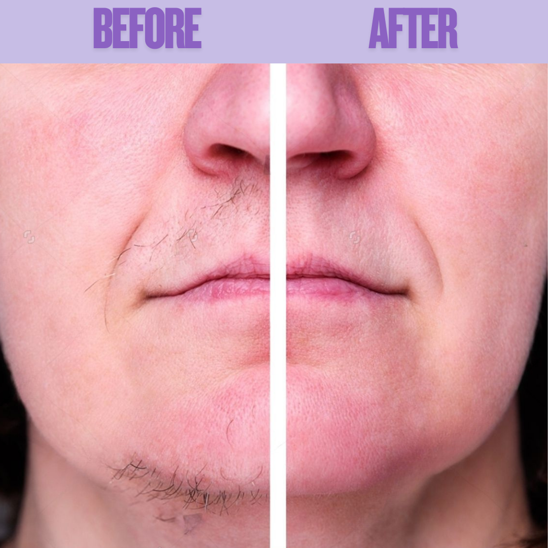 Elaris Facial Hair Removal Cream