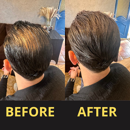 Elaris Hair Concealer