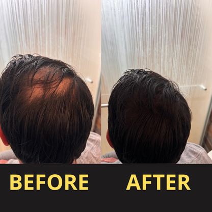 Elaris Hair Concealer