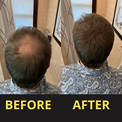 Elaris Hair Concealer