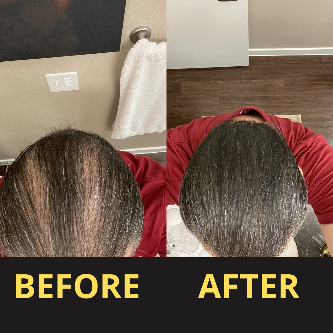 Elaris Hair Concealer