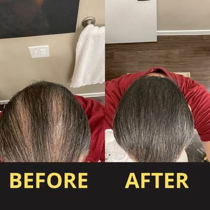 Elaris Hair Concealer