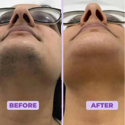 Elaris Facial Hair Removal Cream