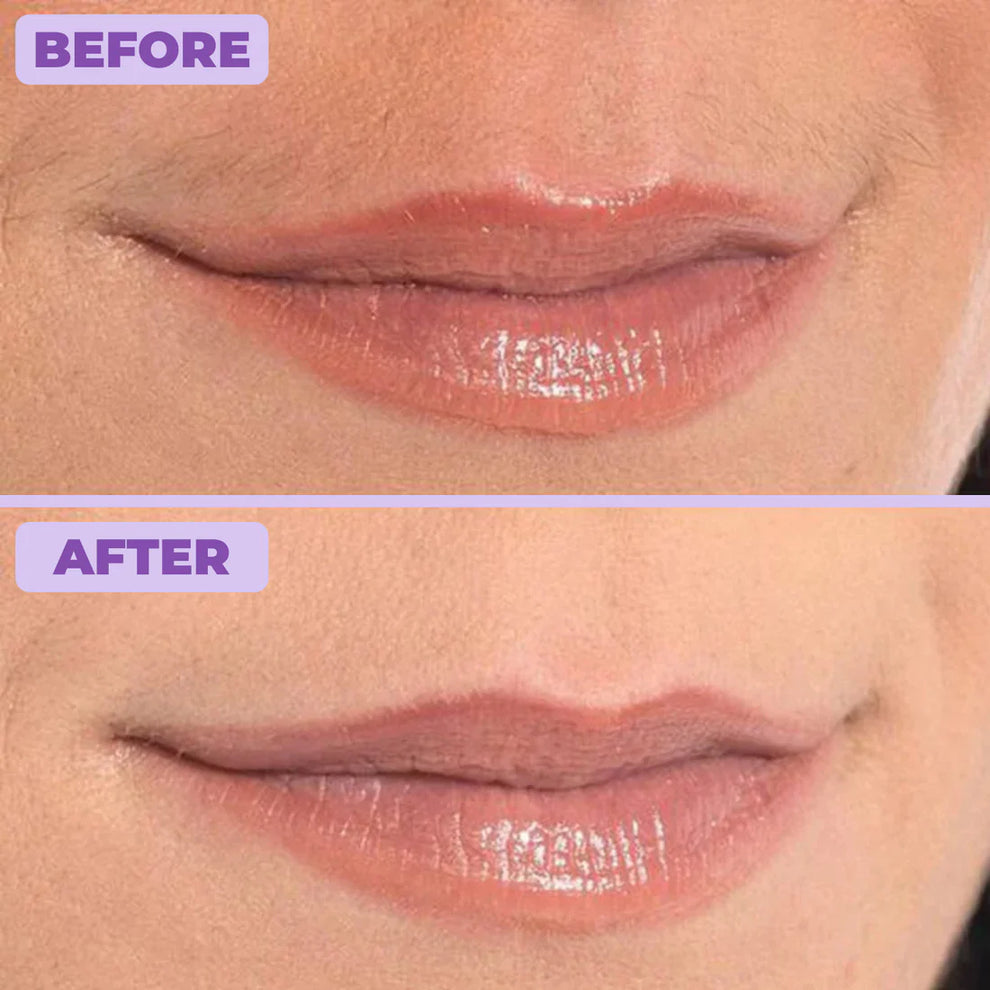 Elaris Facial Hair Removal Cream