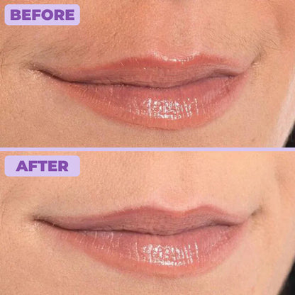 Elaris Facial Hair Removal Cream